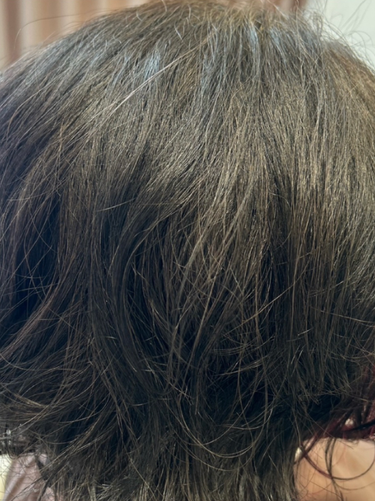 施術後の写真